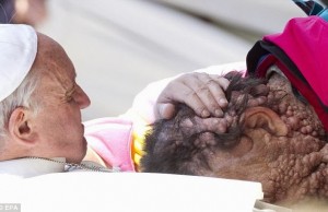 pope francis kisses man with boils